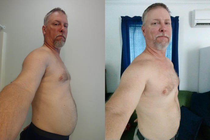 ChrisR CalotrenBefore and After