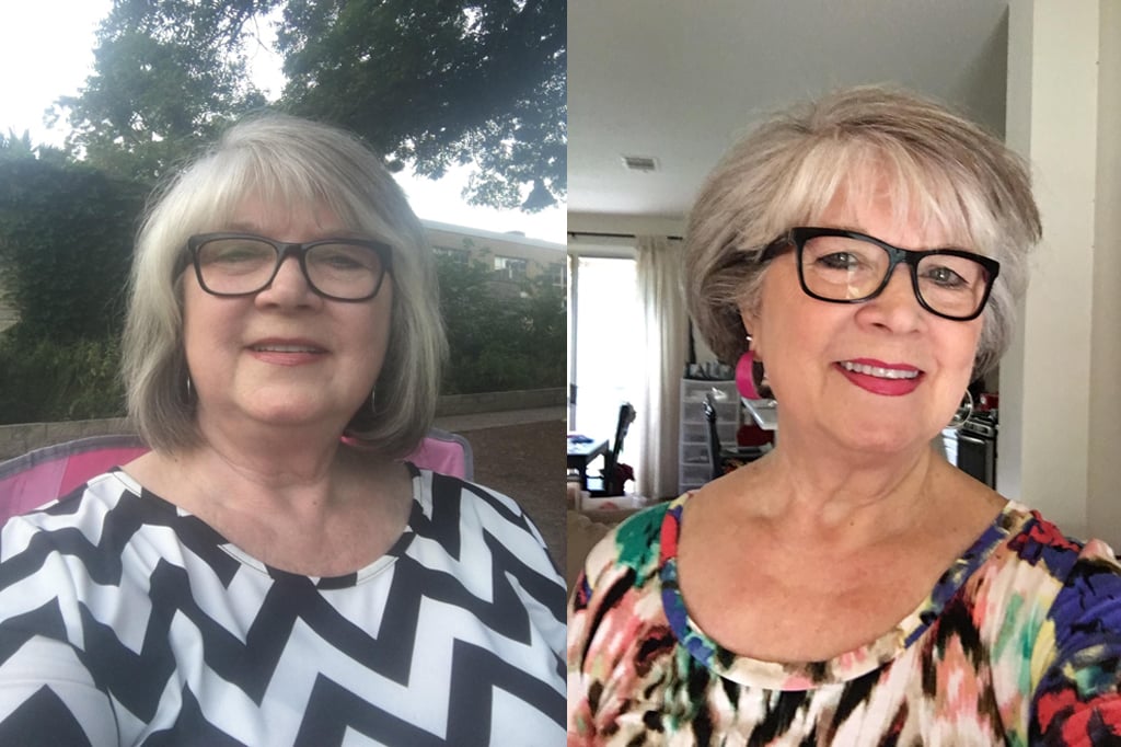 Linda C. Calotren Before & After Pics
